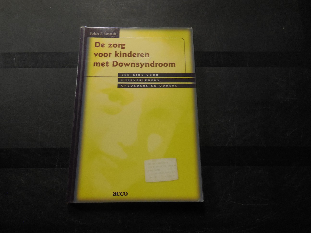 De zorg voor kinderen met downsyndroom